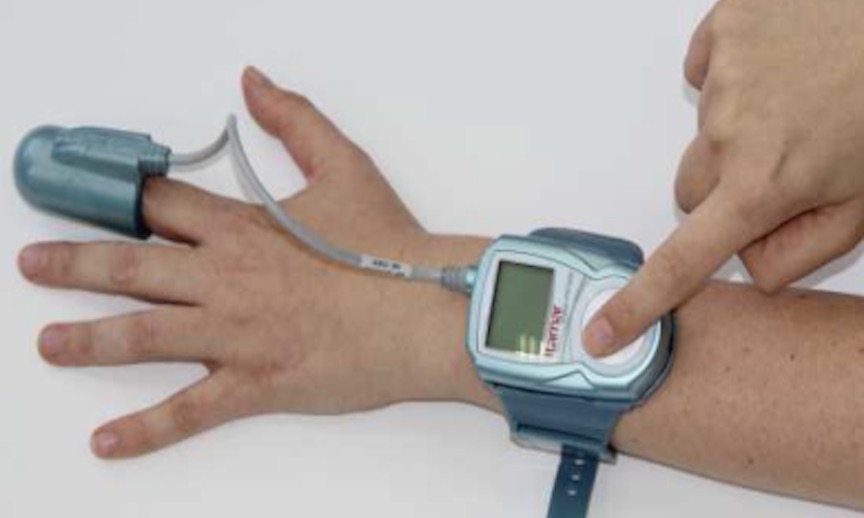 Itamar Medical's WatchPAT (Courtesy)