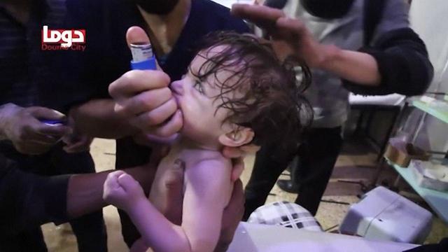 Children treated after alleged chemical attack in Douma